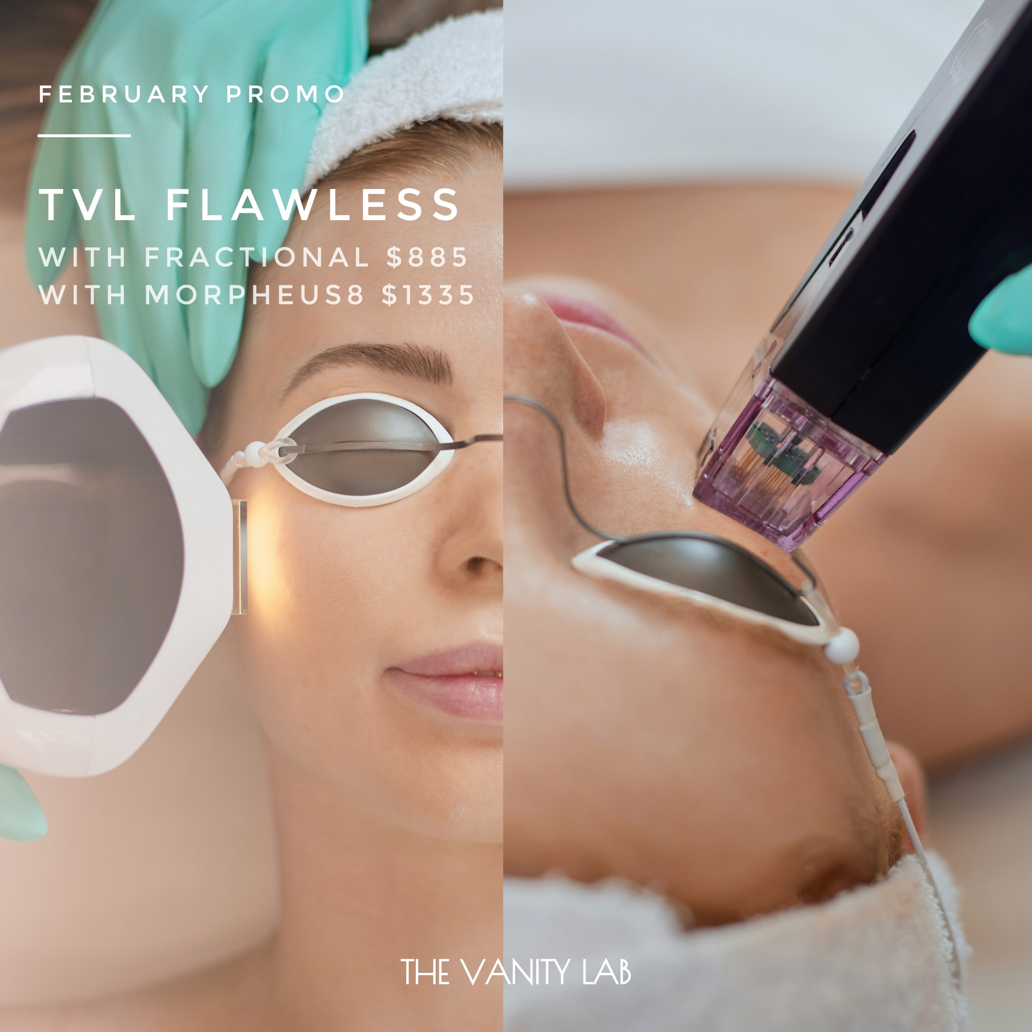 TVL Flawless - February Special product image